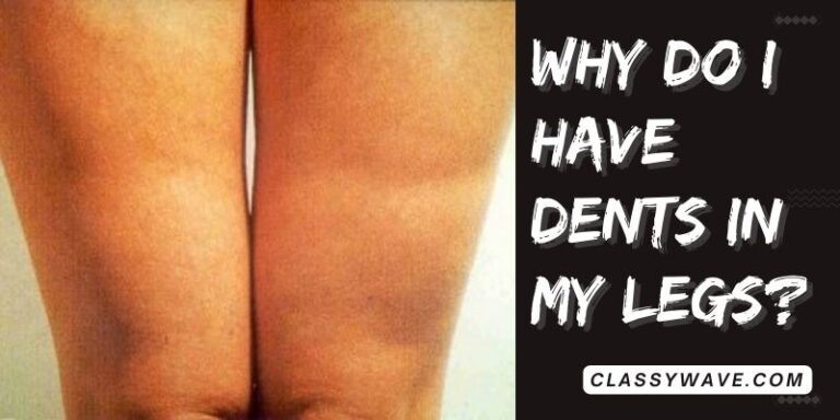 why do I have dents in my legs? Addressing Leg Dents