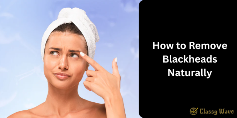 How to Remove Blackheads Naturally | Classy Wave