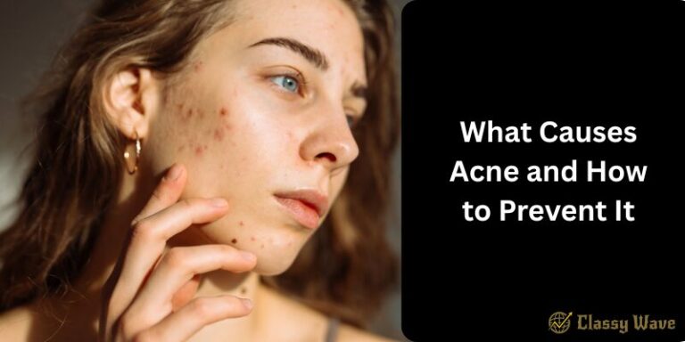 What Causes Acne and How to Prevent It | Classy Wave